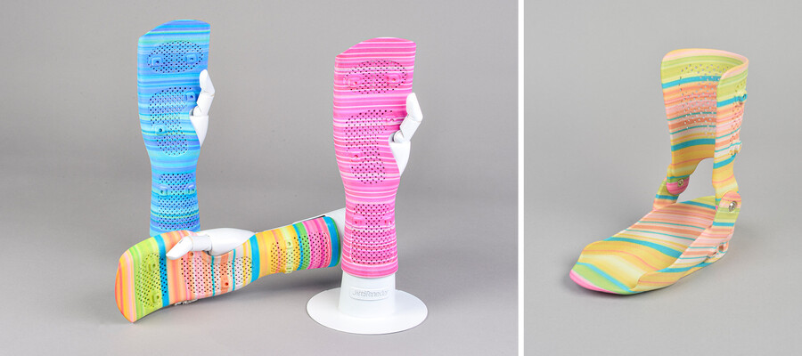 OT4.STYLE – farbige Orthesen für Kinder, gedruckt in 3D